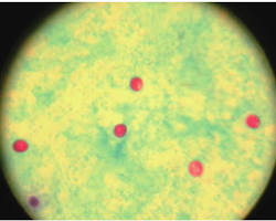 An image of the bacteria of cryptosporidium under a microscope
